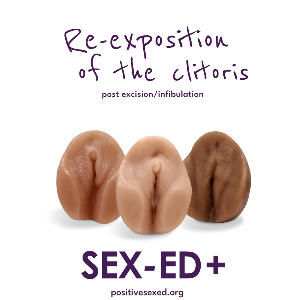 Re-exposition of the clitoris write-up excision/infibulation : new Sex-ED + anatomical types