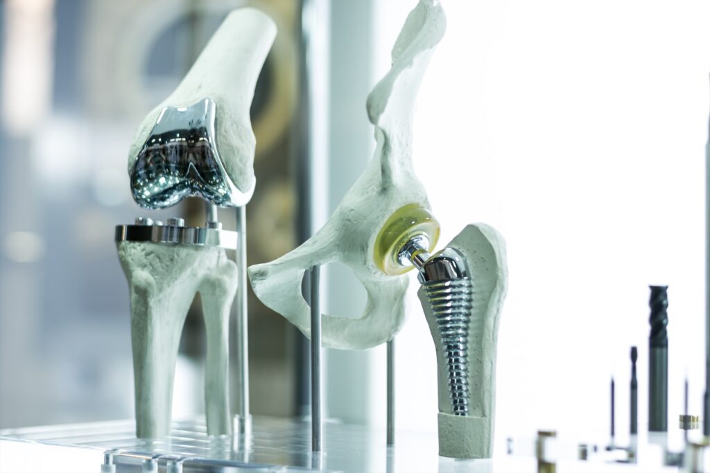 America Orthopedic Biomaterial Market Research on the Industry to Thrive in Upcoming Years