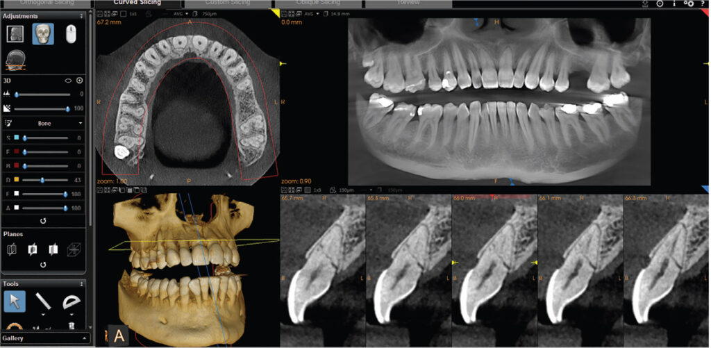 CBCT Dental Imaging Market Research with CAGR values, SWOT Analysis & Future Scope