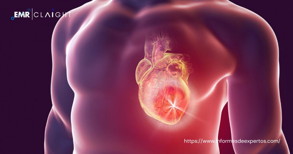Cardiac Biomarkers Market Projected to Surge at 11.60% CAGR During 2023-2028, Surpassing a Value of USD 14.60 Billion in 2022