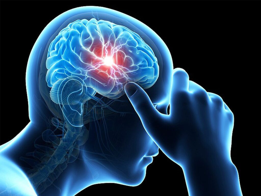 Global Head Trauma Market Research Shows Industry to Register a Phenomenal CAGR