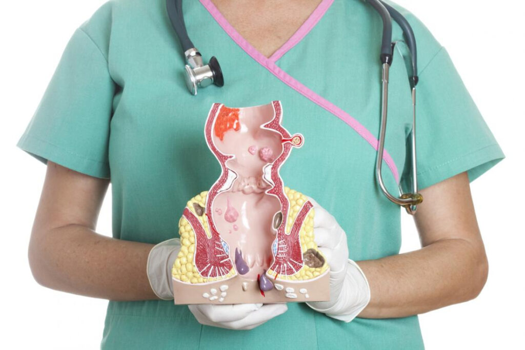 Hemorrhoids Treatment Market Research Report on Industry Trends and Segmental Analysis