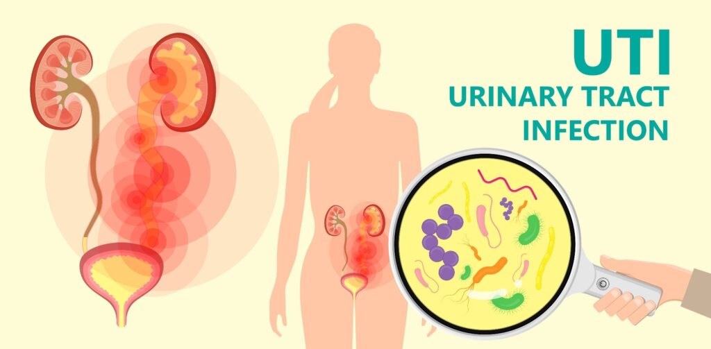 What Causes Urinary Disease?