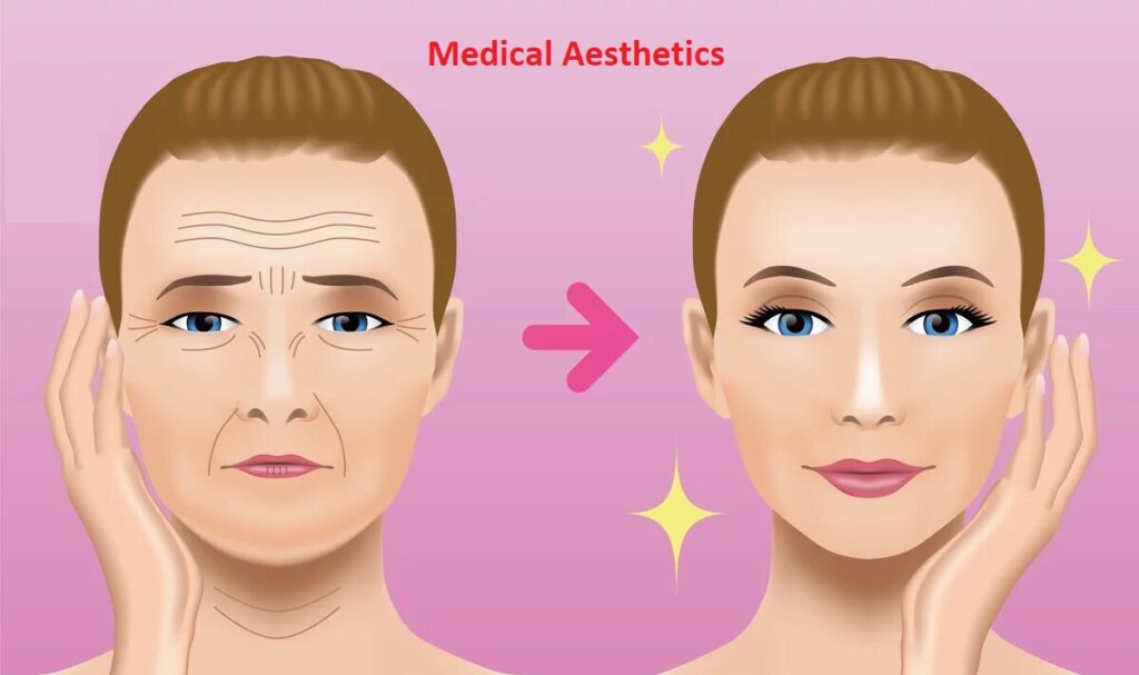 Global Medical Aesthetics Market Trends Perceives a Fortifying Growth in Upcoming Years; Confirms MRFR
