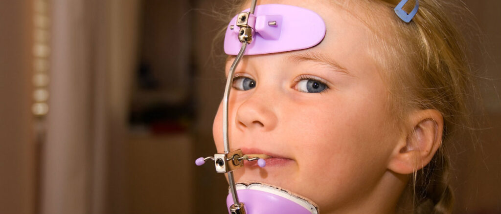 Global Orthodontic Headgear Market Trends to Register a Steady Growth by 2030; Asserts MRFR