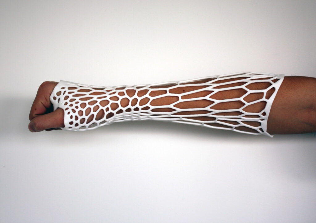 Orthopedic Braces Market Research on Segmentation of the Industry by Type & Components