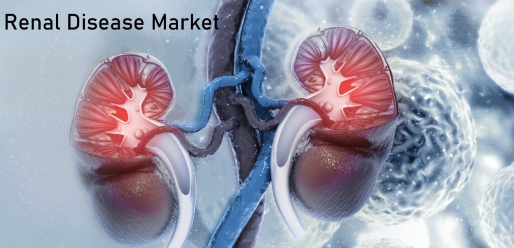 Renal Disease Market Trends to Enjoy 11.20% CAGR over the Forecast Period