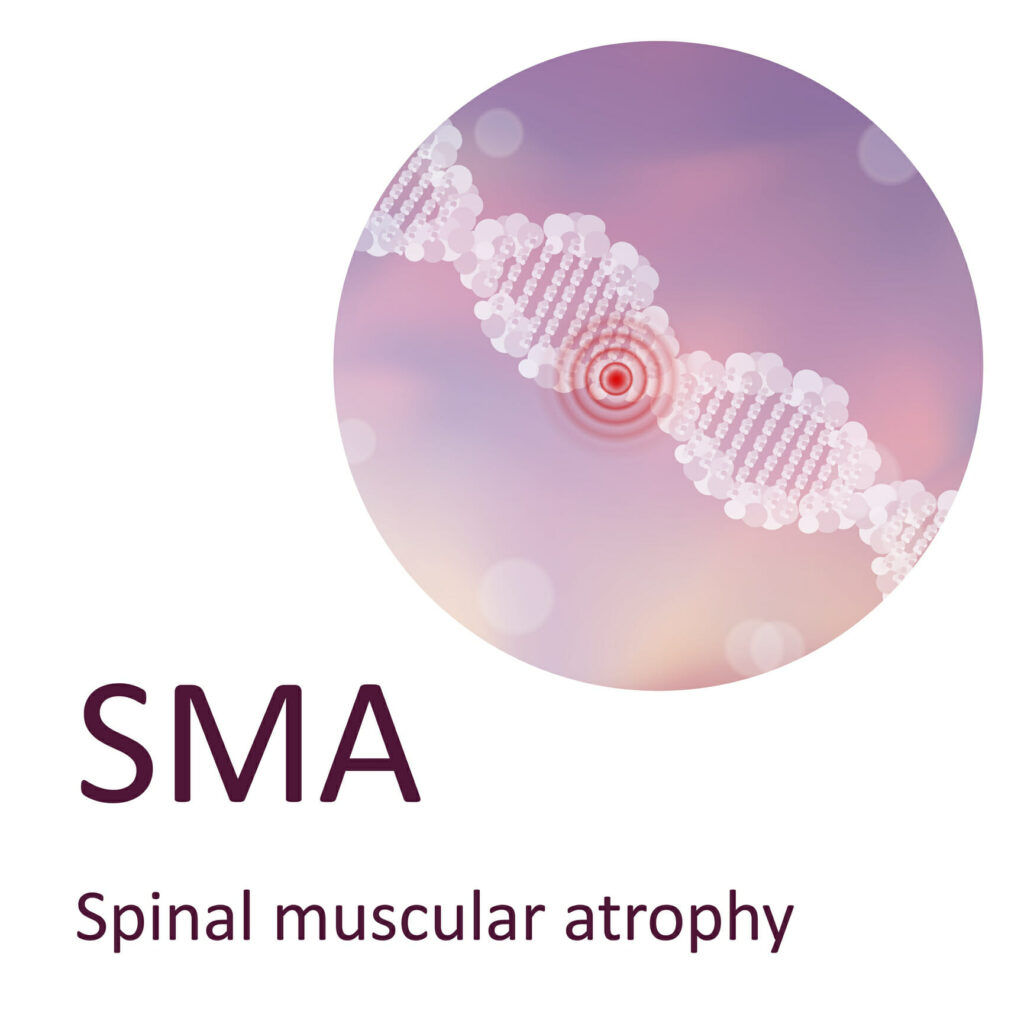 Understanding Spinal Muscular Atrophy Disease: Causes and Symptoms