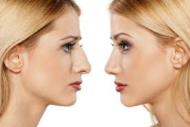 Beyond Aesthetics: The Cultural Significance of Rhinoplasty in Dubai