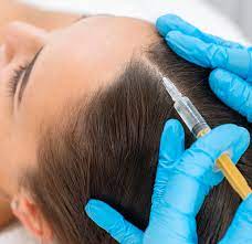 10 Easy Steps to PRP Hair Restoration in Dubai