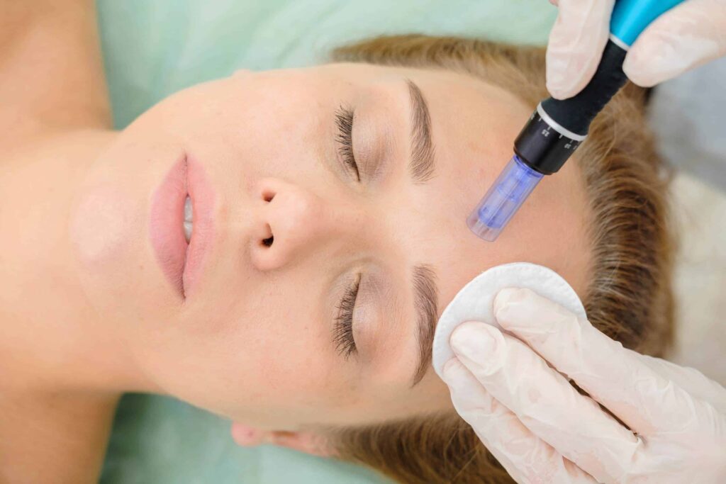 Diving into Dermapen: Dubai’s Skincare Obsession?