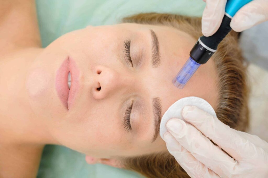 Diving into Dermapen: Dubai’s Skincare Obsession?