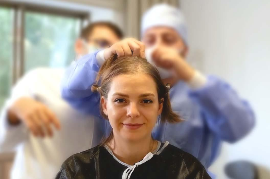 10 Hints for an Effective Hair Transplant in Dubai