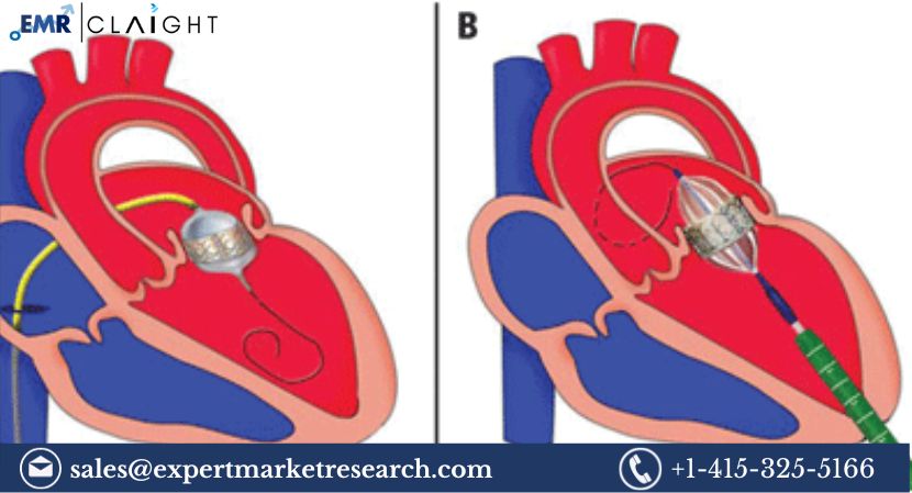 Transcatheter Heart Valve Replacement and Repair Market Size, Share, Price, Trends, Growth, Analysis, Report and Forecast 2024-2032