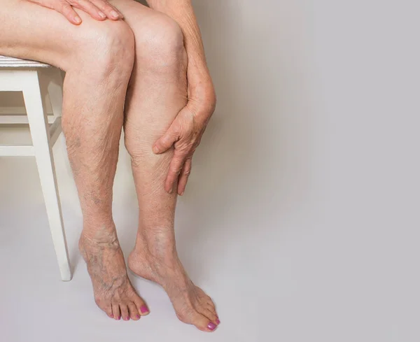 Dubai’s Leg Transformations: Defying Varicose Odds?