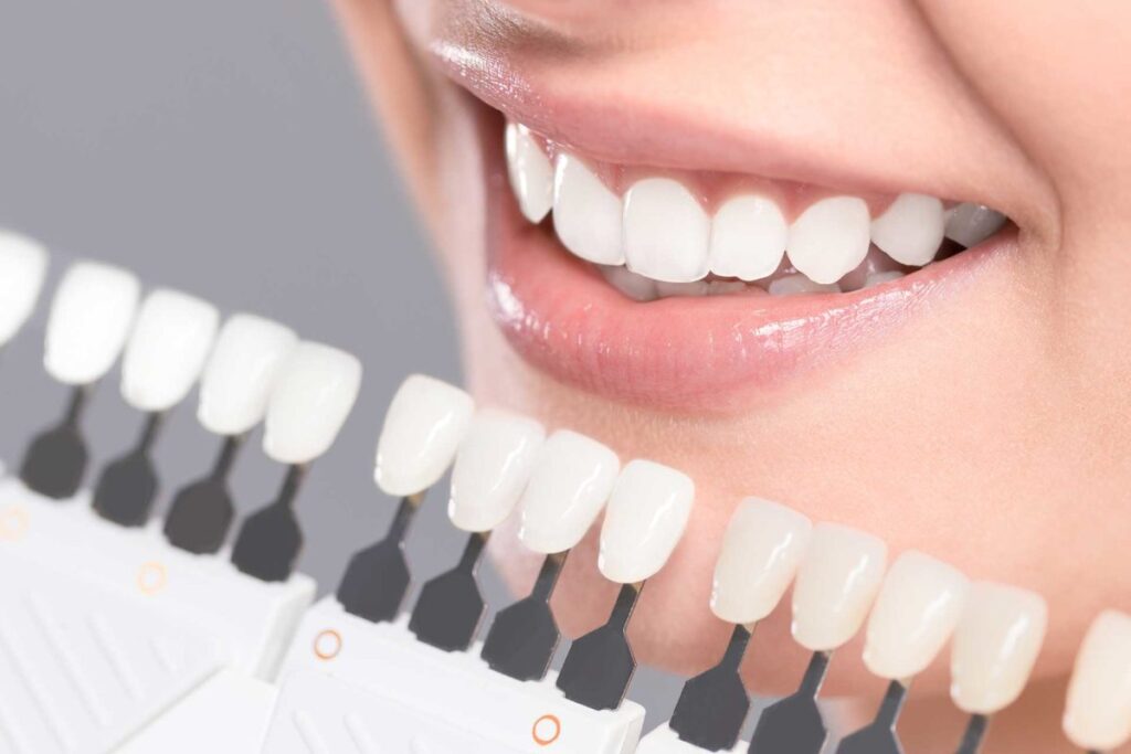 Can Orthodontic Braces Correct Overbites And Underbites?