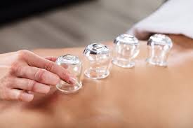 Unlocking the Potential of Cupping for Cellulite Reduction: A Comprehensive Guide